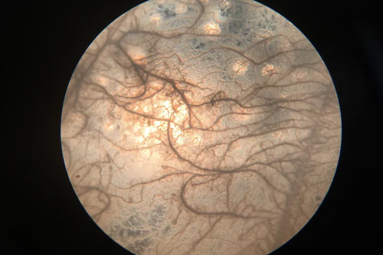 bacterien phenotypes