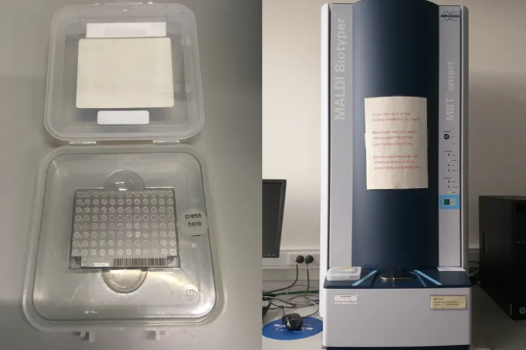 MALDI-TOF bacteriele identificatie