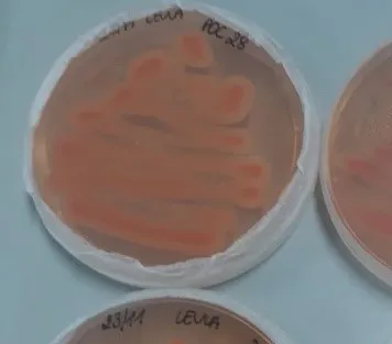 Bacteriën op een groeiplaat